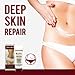 Stretch Marks and Scar Removal Cream | Natural Pregnancy Stretch Mark, Scars and Skin Repair Treatment | Hydration, Exfoliation, Tightening, Collagen Boost | Belly Care for Pre-natal Post-natal | 1 pc