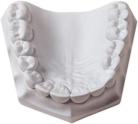 WPM Mounting Plaster White Fast Set 50Lb/22kg