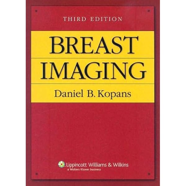 健康・医学 Breast Ultrasound A. Thomas Stavros Breast Ultrasound: 9780397516247: Medicine & Health Science