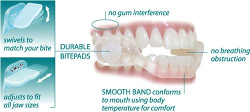 Sleepright Slim Comfort Dental Guard Ebay