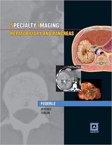 Specialty Imaging Hepatobiliary And Pancreas Federle Michael P M D Jeffrey R Brooke M D Tublin Mitchell E M D Borhani Amir A M D 9781931884679 Amazon Com Books Specialty Imaging Hepatobiliary And Pancreas Federle Michael P M D Jeffrey R Brooke M D Tublin Mitchell E M D Borhani Amir A M D 9781931884679 Amazon Com Books
