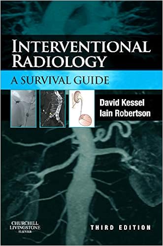 Interventional Radiology A Survival Guide 9780702033896 - 