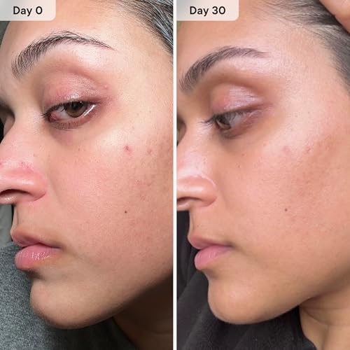 Qure Micro-Infusion System for Face - Blue Formula for All Skin Types, Easy 5min Skincare Facial Application - 3 Month Supply