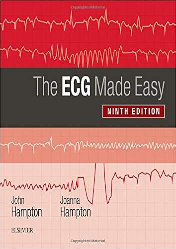 The Ecg Made Easy 9e Amazoncouk John Hampton Dm Ma - 