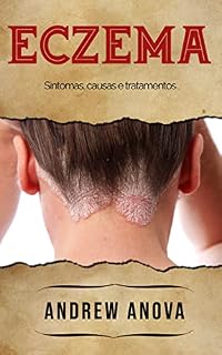 Livro ECZEMA: Sintomas, causas e tratamentos