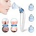 Pore Cleaner Blackhead Remover Facial Pore Cleaner Electric Pore Vacuum Extraction Removal Rechargeable Skin Peeling Machine with 4 Replaceable Suction Heads