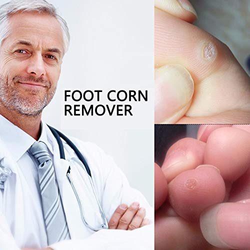 Corn Remover Pads, Corn Removal, Wart Removal, It is a Better Solution for People Who Suffer The Pain of Corn, Wart & Callus, 24Pcs/Box
