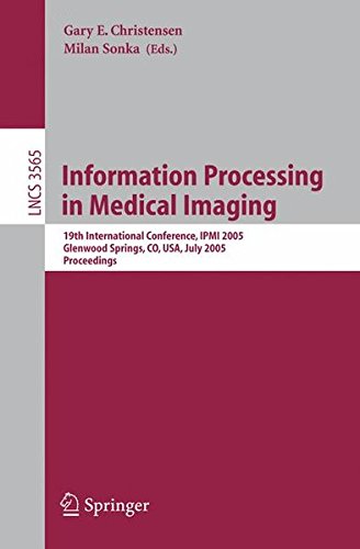 Download Information Processing in Medical Imaging: 19th International Conference, IPMI 2005, Glenwood Springs, CO, USA, July 10-15, 2005, Proceedings (Lecture Notes in Computer Science) Download Information Processing in Medical Imaging: 19th International Conference, IPMI 2005, Glenwood Springs, CO, USA, July 10-15, 2005, Proceedings (Lecture Notes in Computer Science)