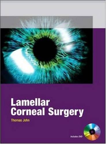 LAMELLAR CORNEAL SURGERY