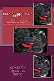 Ecocardiografia Fetal (Spanish Edition)