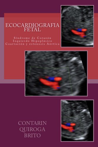 Ecocardiografia Fetal (Spanish Edition)