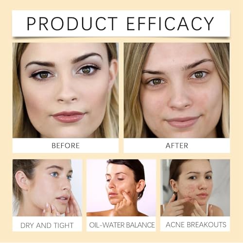 LBOYLOVE® Centella Cleansing Oil, Natural Oil Cleaner, Face Cleanser Women, Oil-Based Facial Cleanser Gentle Makeup Removal, Make Up Remover, Cleansing Oil for Face, Face Wash Women, Gentle Cleanser