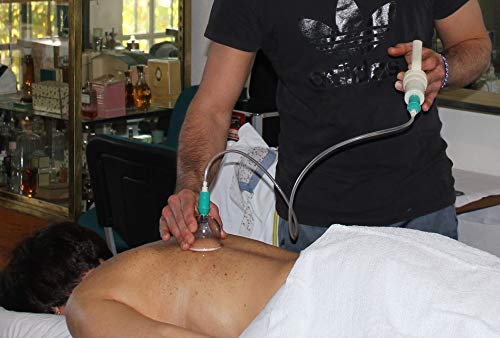 4 Cupping+Professional+Acupoint+Magnetic+Cellulite