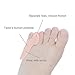 Povihome 4 Pack Bunionette Corrector, Tailor's Bunion Pads, Gel Pinky Toe Protector for Bunionette Pain Relief Little Toe Bunion Guard