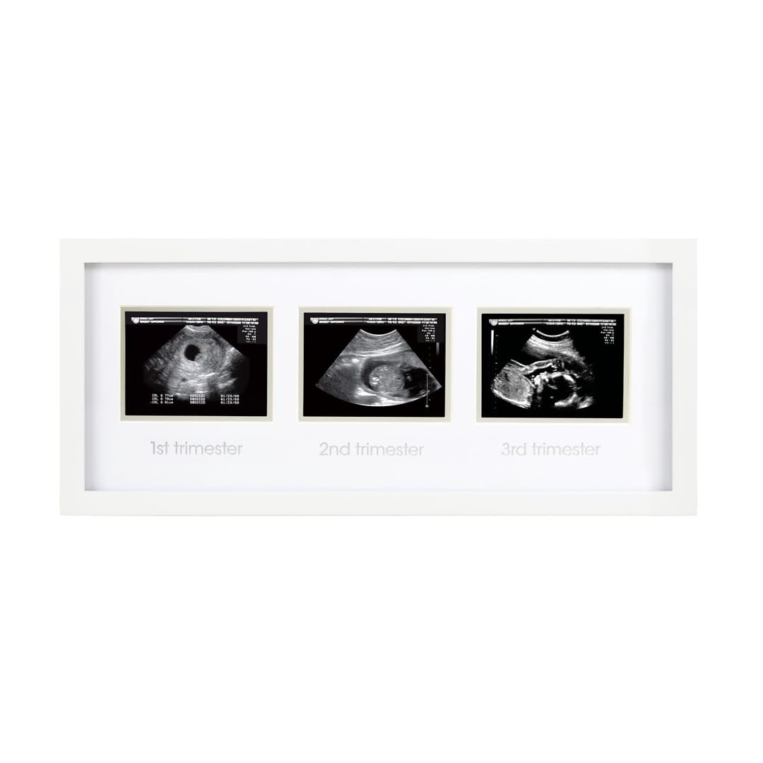 Pearhead Trimester Sonogram Picture Frame, Pregnancy Photo Milestone Wall Decor, Ultrasound Keepsake, Gender-Neutral Baby Nursery Décor, White