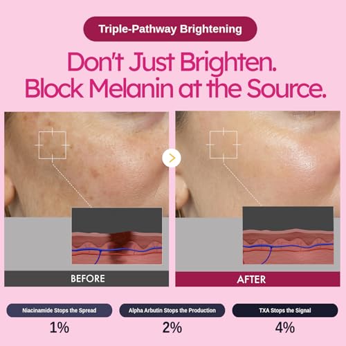Alpha Arbutin Cream with Niacinamide for Even Skin Tone, Blemishes, Korean Skin Care, 50ml, 1.69 fl.oz.