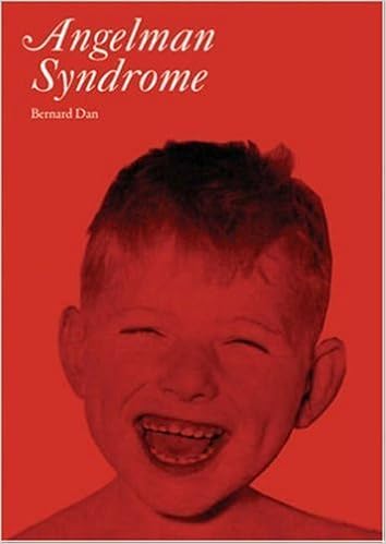 Amazon Fr Angelman Syndrome Clinics In Developmental Medicine By Bernard Dan 08 06 27 Livres