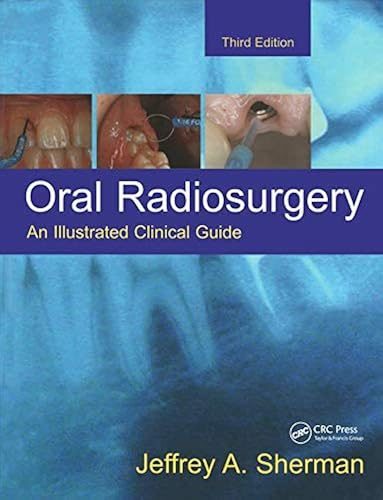 Download Oral Radiosurgery: An Illustrated Clinical Guide PDF