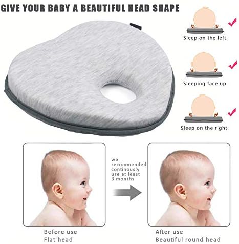 baby's flat head shape