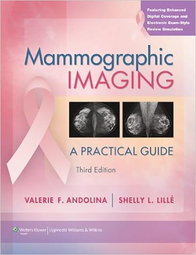 Mammographic Imaging A Practical Guide Point Lipcott Williams Wilkins Kindle Edition Andolina Valerie F Professional Technical Kindle Ebooks Mammographic Imaging A Practical Guide Point Lipcott Williams Wilkins Kindle Edition Andolina Valerie F Professional Technical Kindle Ebooks