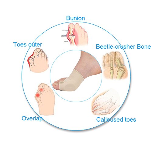 Bunion Corrector and Bunion Relief Kit for Bunion, Hallux Valgus, Big Toe Joint with Protector Sleeve, Separators, Straightener Splint and Foot Massage Ball by Jarvania - Thumbnail 4