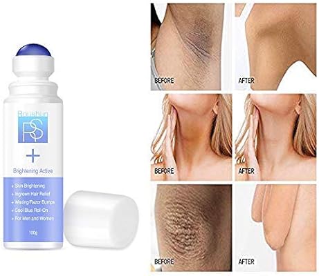 Whitening Skin Bleaching Cream Roll On Formula Treats Ingrown