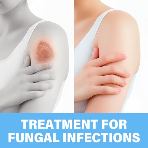 Skin Fungus Cream, Intensive Treatment for Athlete's Foot, Eczema, Groin Fungus & Tinea Versicolor, Suitable for Face and Body Care, Non-Irritating, 60 ml