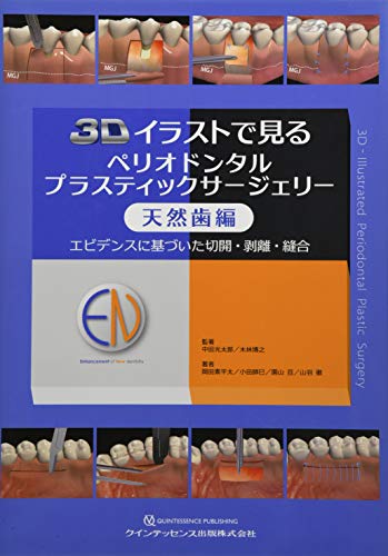 3dイラストで見るペリオドンタルプラスティックサージェリー 天然歯編 3dイラストで見るペリオドンタルプラスティックサージェリー 天然歯編