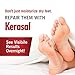 Kerasal Intensive Foot Repair, Deeply Moisturizes – Visible results in just 1 day – 1 Ouncethumb 4