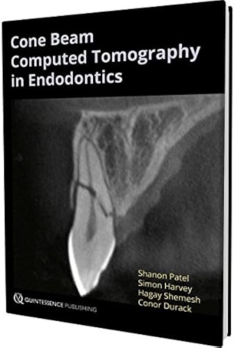 Download Cone Beam Computed Tomography in Endodontics PDF
