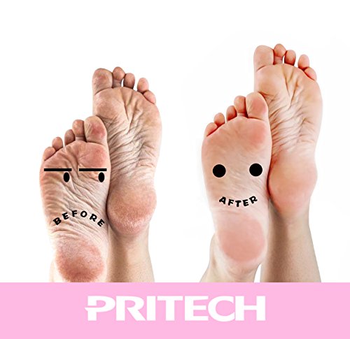 Electric Callus Remover - PRITECH Electronic Pedicure Tools, Professional Wet and Dry Rechargeable Foot File Removes Dead, Hard, Cracked Skin With Fine & Rough Roller and Protective Cover