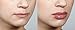 WUNDERKISS - Lip Plumping Gloss with Plumping Booster