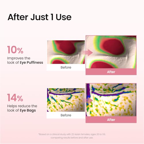 BIODANCE Collagen Peptide Under Eye Patches 60 Counts. Advanced Hydrogel Eye Patches for Dark Circles & Puffy Eyes. Under Eye Mask for Fine Lines. Eye Bags & Wrinkles. Korean Skincare.