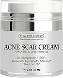 Acne Scar Cream from New York Biology - EGF Anti Acne Cream Helps Get Rid of Acne Scars while Hydrating & Regenerating Skin - 1.7 fl oz