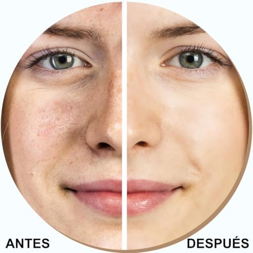Dispositivo de Esfoliação Ultrassónica com 4 Funções: Ultrassons, Iões, EMS, LED, Remoção de Pontos Negros, Acne, Limpeza de Poros, Esfoliação (Levantamento do Kit de Iniciação)