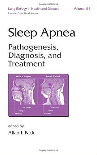 Sleep Disorders Online Free Ebooks Download Sites - 