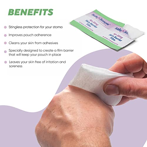 Safe n' Simple No Sting Skin Prep Wipes 75 Individual Ostomy Barrier