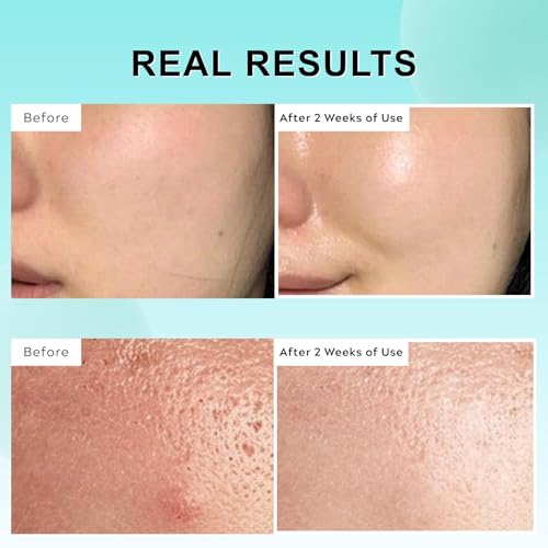 LBOYLOVE® PDRN 100 Essence, PDRN Serum Korean, Intensive Glow Serum for Face Glass Skin, Smooth Fine Lines, Boost Elasticity, Skin Restoration & Plumping, Hydrating & Moisturizing, 30ml