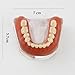 Dentalmall Implant Model Typodon Dental Model with 4 Implant Pins for Teaching Students (6008 Gold)