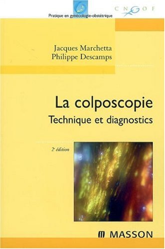La  colposcopie