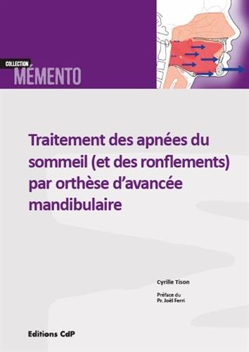Traitement des apnées du sommeil et des ronflements par orthèse d'avancée mandibulaire