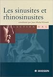 Image de Les sinusites