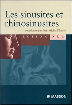 Les sinusites Les sinusites