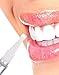 Ultimate Strength Peroxide Teeth Whitening Pen Tooth Cleaning Bleaching Gel