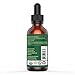 Gio Naturals Castor Oil - USDA Certified Organic, 100% Pure, Cold Pressed, Hexane Free - Stimulate Growth for Hair, Eyelashes, Eyebrows - Boosts Growth Instantly! Moisturize & Heal Dry Skin & Scalp