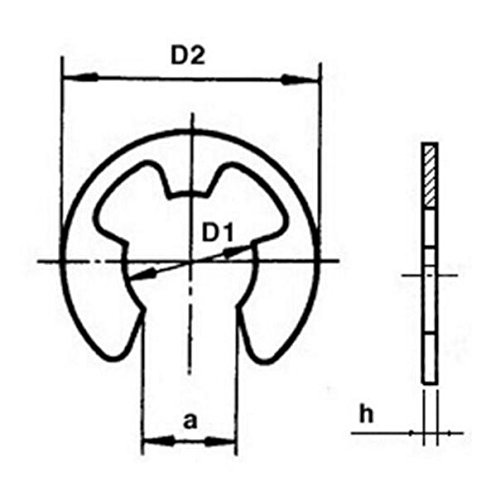 2 LinaLife+Stainless+Retaining+Assortment+1+5mm+10mm