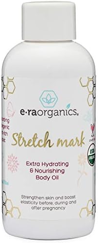 organic stretch mark removal