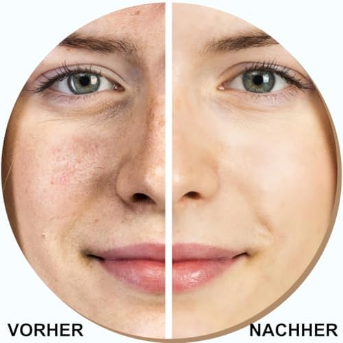 Ultraschallpeeling-Gerät & Porenreiniger Set – Inkl. 400ml Lifting-Toner & Mitesserentferner, 5-in-1 Skin Scrubber mit Ionen, EMS & LED – Für strahlende Haut & Anti-Aging