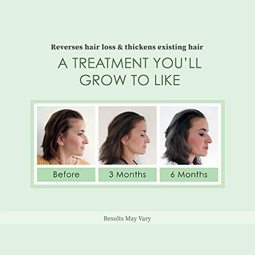 REGROWZ Women's 100 Natural Topical Hair Restoration Treatment for Regrowth, Hair Loss