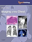 Imaging of the Chest, 2-Volume Set: Expert Radiology Series, 1e-Wow! eBook